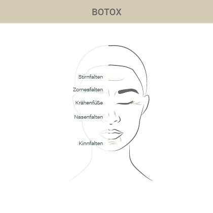 Graphik zur Botox Faltenunterspritzung - Dr. Esfahani in Köln 