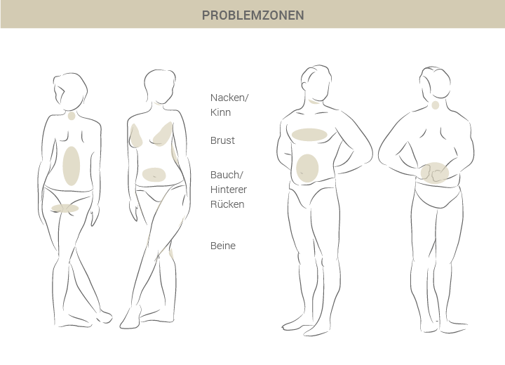 Graphik zu Fettabsaugung Problemzonen - Dr. Esfahani in Köln 
